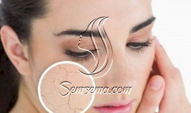 3 خطوات تجنبك جفاف البشرة في الشتاء