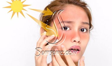 نصائح هامة لحماية بشرتك من الشمس صيفاً