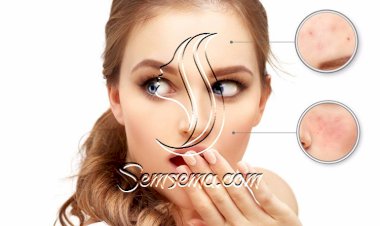 تخلصي من الزوائد الجلدية بهذه الوصفات