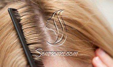 اللبن الرائب وعصير الليمون لعلاج قشرة الشعر