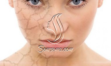 ترطيب البشرة بطرق طبيعية