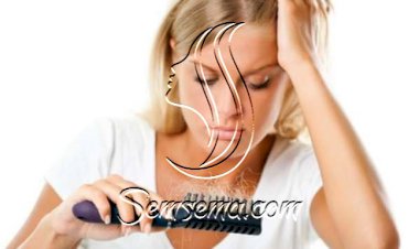 3 وصفات طبيعية لعلاج تساقط الشعر من الأمام