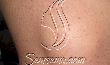 مشكلة نمو الشعر تحت الجلد أسباب وعلاج طبيعي