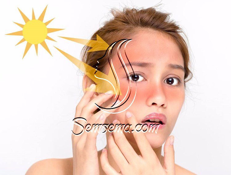 نصائح هامة لحماية بشرتك من الشمس صيفاً